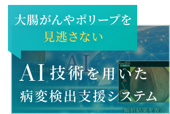 大腸がんや胃がんを見逃さないAI技術を用いた病変検出支援システム使用