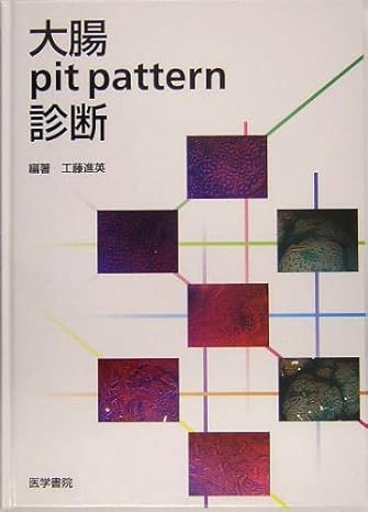 大腸pit pattern診断