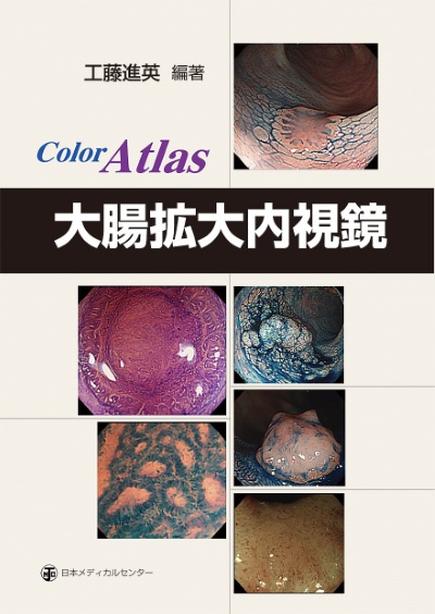 大腸拡大内視鏡―Color atlas