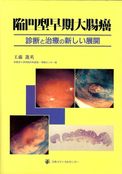 陥凹型早期大腸癌―診断と治療の新しい展開