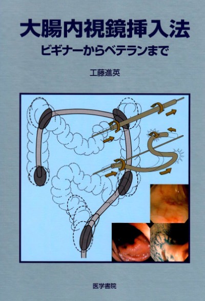 大腸内視鏡挿入法―ビギナーからベテランまで