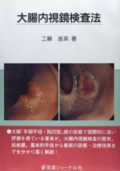 大腸内視鏡検査法